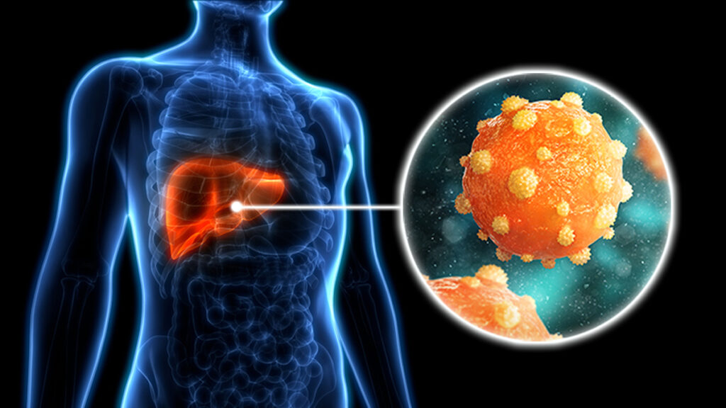 Hepatitis: All You Need To Know About It