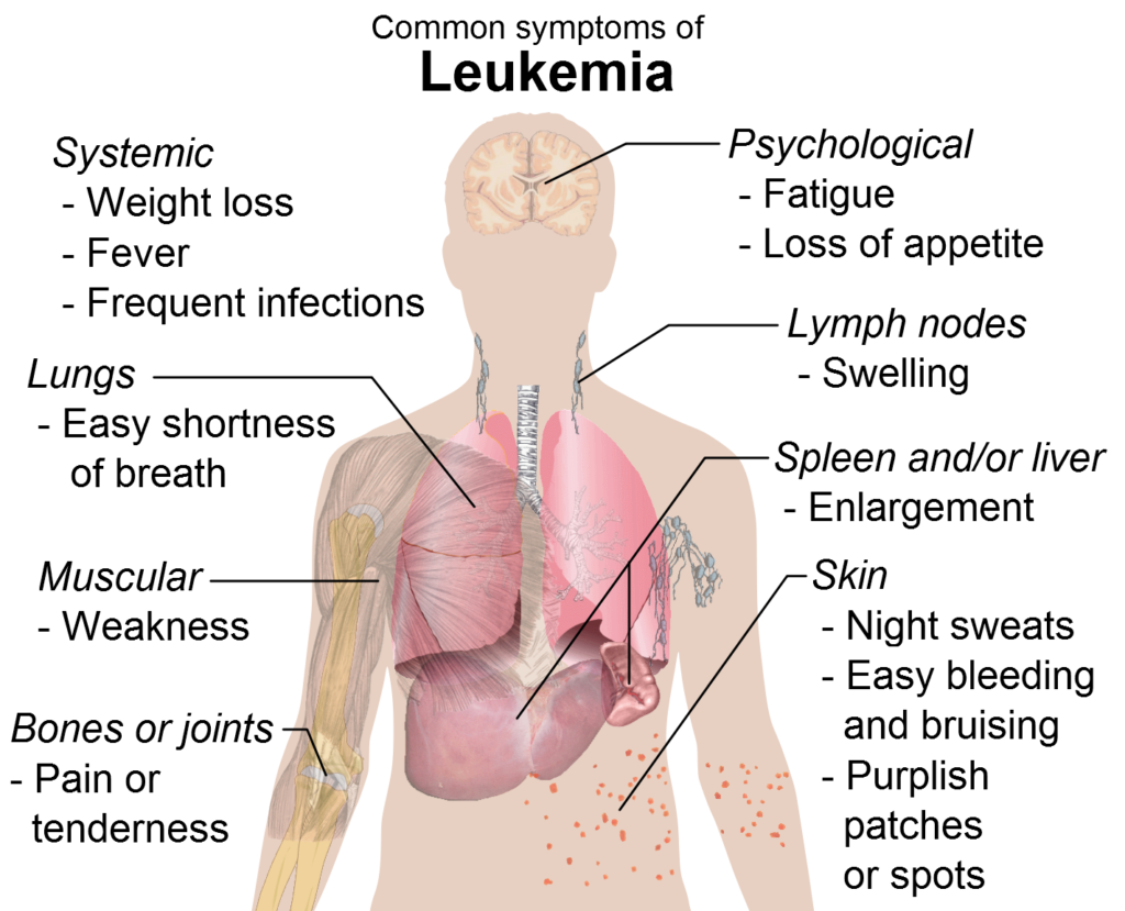 Understanding Leukaemia